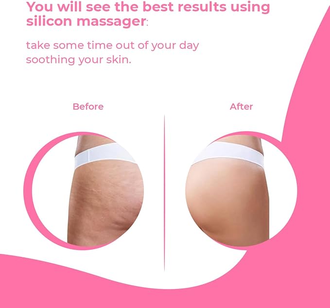 Anti Cellulite Massager Roller - Anticellulite Fascia Blaster for Cellulite Remover - Improves Blood Flow Use Cellulite Brush & Cellulite Roller with Cream or Oil for Cellulite Treatment