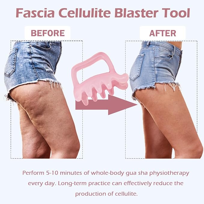Fascia Massage Tool for Cellulite Trigger Point Tool Blaster Massager for Deep Myofascial Tissue Body Release Muscle Knot Cellulite Remover