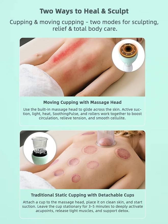 Electric Cupping Kit for Massage Therapy with Heat – Cellulite Massage Tool, Lymphatic Drainage Massager, Pain Relief for Back, Neck & Shoulders – Moving & Static Cupping Set for Body Sculpting