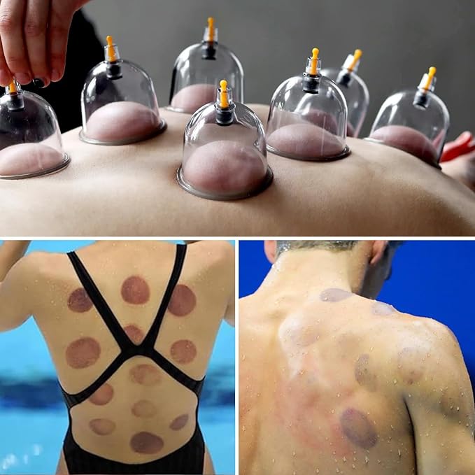 Cupping Kit for Massage Therapy - 32 Cups Professional Chinese Cupping Set with Magnetics, Vacuum Cupping Therapy Set for Cellulite Reduction Muscle Pain Relief with Manual Pump