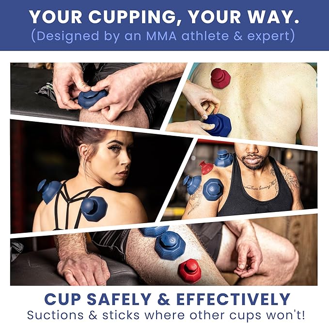 Cupping Therapy Set – Cupping Kit for Massage Therapy – Silicone Cups – Massage Cups – Smart Cupping for Fascia and Myofascial Release (Large, Blue)
